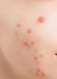 sever health condition